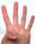 4 fingers